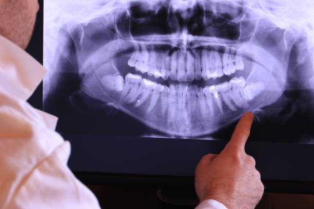 Best Emergency Tooth Extraction  in Cashmere, WA